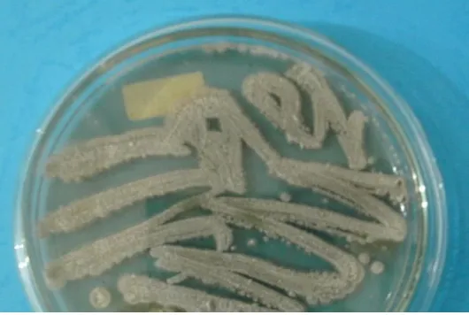 Gambar 2. Isolat Actinomycetes pada media ISP-2  