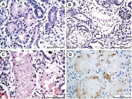 Figure 1. All pictures correspond to kidneys of 13-week fetuses. A. fetus with no acute tubular necrosis for compari-son