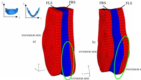 Figure 6. Deformation of the bone callus: (a) anterior view and (b) posterior view 