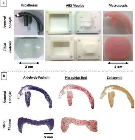 Fig. 11. Creating scaled-up, anatomically shaped alginate constructs. (a) Prostheses of the femoral condyle and tibial plateau were used to create acrylonitrile butadiene styrene (ABS) reverse moulds, from which scaled-up, anatomically shaped BMSC seeded a