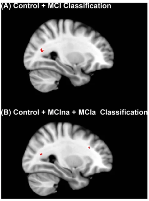 Figure 9. Top 500 voxels selected for classification by theRelieff algorithm. (a) Classification of control and MCI groups