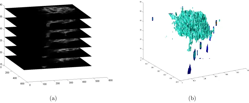 Figure 1. Sample of image stack and the result of 3D segmentation. (a) is a stack of 2-D image slices captured at diﬀerentdepth of a neuron specimen
