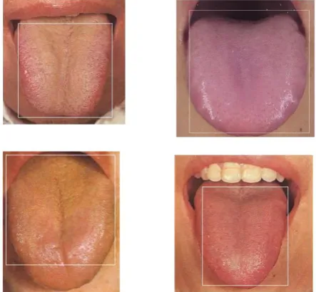 Fig. 3. Tongue segmentation result image.  
