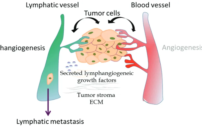 Figure 3. Schematic overview of processes involved in tumor lymphangiogenesis and metastasis