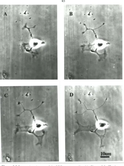 Figure -3.3 Successive pictures o/the SCG neuron outlined in Figure 32. The images were taken every 20 minutes