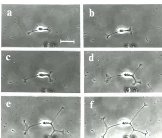 Figure 4.2 Neurite outgrowth/rom a second cell. Thirty minutes elapsed between photographs