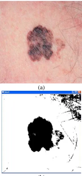 Fig. 9. OTSU process result (a) input image, (b) output image  