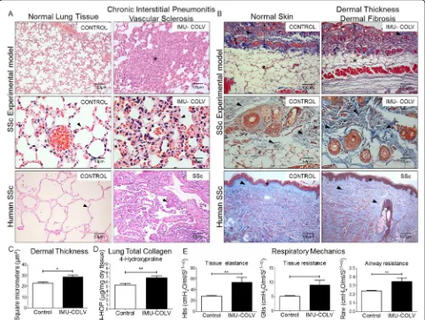 Fig. 2 Changes in lung and skin morphology, dermal thickness, total lung collagen, and lung mechanics following the immunization with Col Vin C57BL/6 mice and human SSc