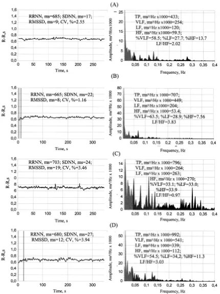 Figure 7. Indices of heart rhythm variability in a 55-year-old woman in a supine position (A) and in the active orthostatic test (B) initial state;during the after-effect of the prolonged unperceived aromatherapy: (C) = supine position; (D) = orthostatic t
