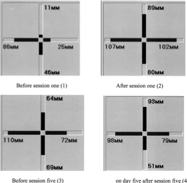 Figure 9. Optimization of stability zone in a 52-year-old woman with body deflection in various directions (mm) during a course oftreatment with comprehensive sensory flow (Alpha Capsule)