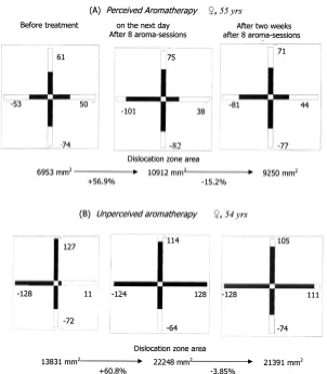Figure 6. Alterations in mean group indices of cardiac rhythm variability in percentage in relation to initial values under the influence= total CR spectral power; VLP = power of very low CR frequency spectral component; LF = power of low CR frequency spec