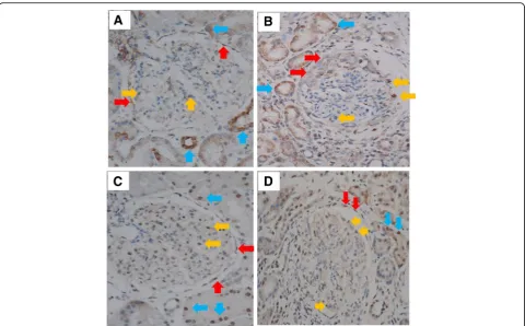 Fig. 2 Detection of IL-28B (IFNL3) and IL-28 receptor alpha (IL-28RA) in kidney tissue of lupus patients with nephritis
