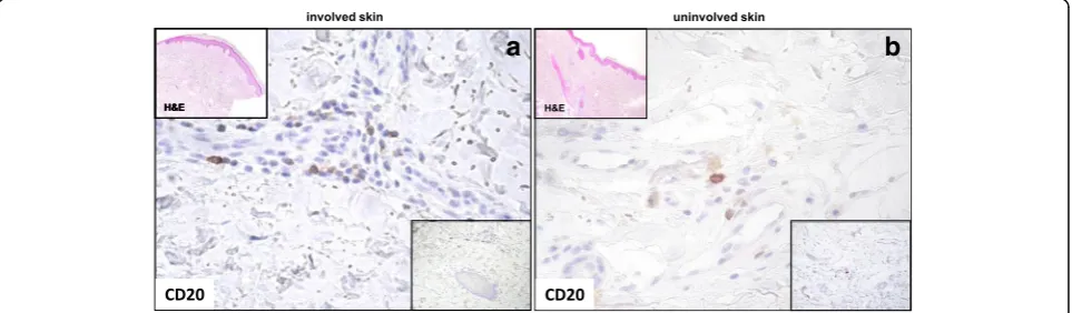 Table 2 CD68+, CD3+, CD20+ and CD138+ cell counts on paired skin specimens in the 28 patients with SSc