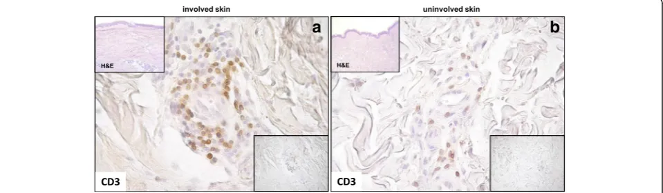 Fig. 2 CD138 cell staining in involved and uninvolved skin from a patient with systemic sclerosis (SSc)