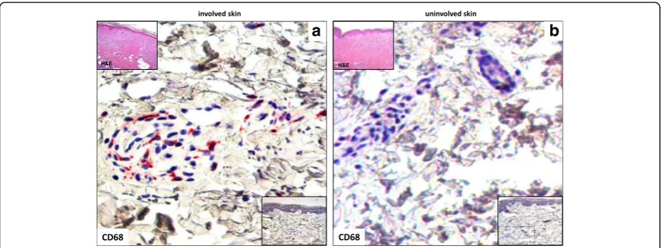 Fig. 4 CD68 cell staining in involved and uninvolved skin from a patient with systemic sclerosis (SSc)