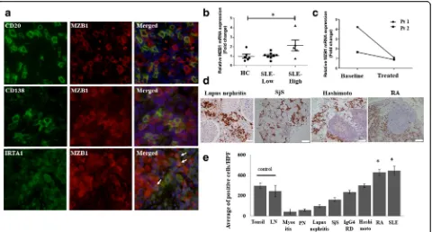 Fig. 2 MZB1 is overexpressed in B-cell subsets andcollected at 2 months of treatment. Relativefrom patients with various autoimmune diseases.sue from rheumatoid arthritis (RA) patients compared with control lymph nodes (LN) and tonsils (in peripheral blood