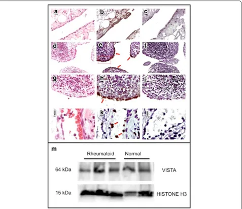 Fig. 1 Immunoreactive VISTA is detected in human synovium tissue sections and lysates of normal and rheumatoid human synovium.cific isotype control antibody staining developed with diamino-benzidine.neutrophils in (ing developed with diamino-benzidine.Norm