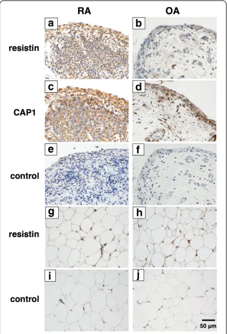 Fig. 1 Expression of resistin and adenylate cyclase-associated proteinhematoxylin. The representative figures of three tissue sections frombody (hwas stained with rabbit anti-resistin polyclonal antibody (1 (CAP1) in the synovial tissue in rheumatoid arthr