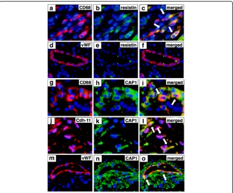 Fig. 2 Resistin-expressing and adenylate cyclase-associated protein 1 (CAP1)-expressing cells in synovial tissues in rheumatoid arthritis (RA).cadherin-11 (Sections of synovial tissue from RA were double-stained with resistin, and CD68 or von Willebrand fa