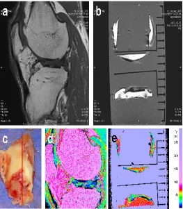 Figure 4. Case B: comparative evaluation between in-vivo (a and d) and in-vitro fresh tissues (b and e)