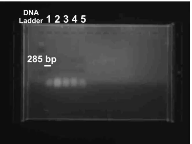 FIG. A.12 : Showing DNA Samples run in 2% agarose gel. 1  :  DNA Ladder 1KB 