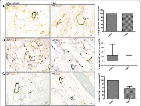 Fig. 6 Expression of Ang/Tie2 in dermal microvessels of TSK1 mice.tight skin 1,respect to the expression of Ang-2, Ang-2, Tie2 ( a, b, c In the TSK 1 model, no significant changes could be observed withbrown staining) in microvessels (vWF positive; blue st