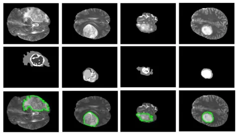 Fig. 4 Visual results in the axial view from the localization phase. The top row shows the T2 modality
