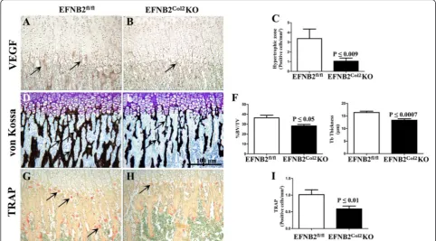 Fig. 4 Impaired vascularization of ephrin-B2 (determined using the MannEFNB2)Col2knockout (KO) cartilage conditional mice at postnatal day P15