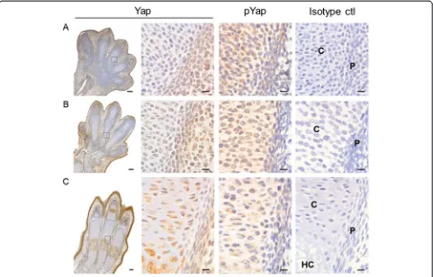 Figure 6 Yap and pYap expression during limb development. Consecutive histological sections from hindlimbs of mouse embryos at E13.5antibody, and counterstained with haematoxylin