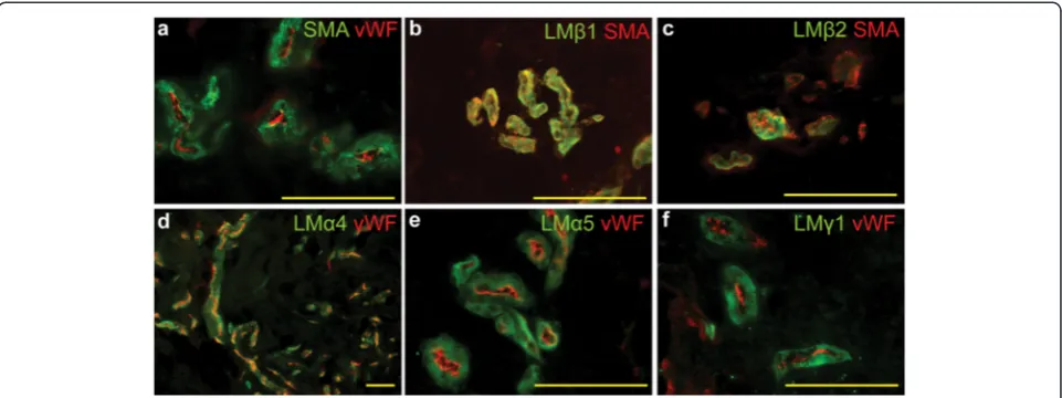 Fig. 4 Laminins 411/421 and 511/521 localize in the small blood vessels in DC. The DC samples were stained with antibodies recognizing lamininsmall blood vessels