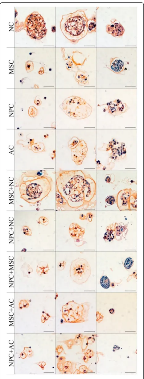 Figure 2 Extracellular matrix deposition. Histopathological slidesof typical cell morphologies on day 28 of notochordal cells (NCs),mesenchymal stromal cells (MSCs), nucleus pulposus cells (NPCs),articular chondrocytes (ACs), MSC + NC, NPC + NC, NPC + MSC,