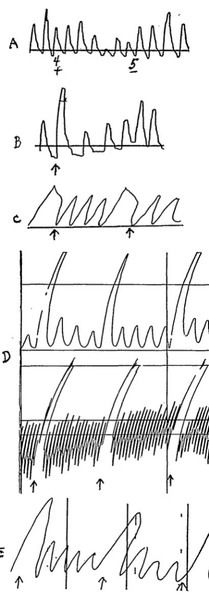 FIGURE 1."yes"-"no" 