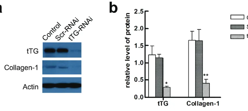 Figure 2 Immunodetection and quantification of tTG by Western blotting. Control, Scr-RNAi and tTG-RNAi, were groups of HSC exposed to Polybrene, GFP-RNAi-Lentivirus, and tTG-RNAi-Lentivirus, respectively