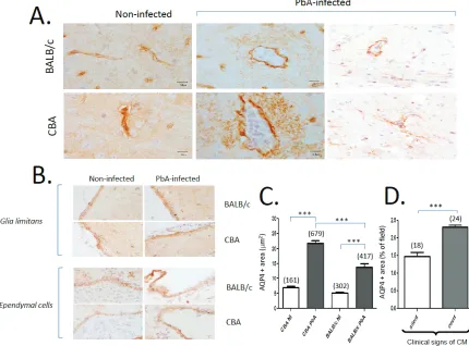 Figure 2. Patterns of AQP4 expression in CM-S and CM-R mice upon PbA infection. A. Distinct patterns of AQP4 ex-pression: selectively increased expression in perivascular spaces in CBA mice with CM, on day 7 p.i