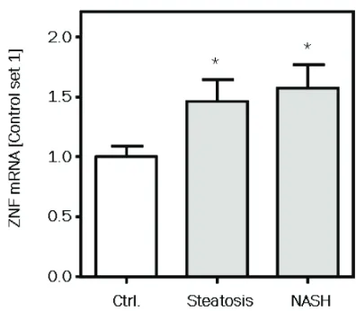 Figure 1. ZNF267 expression in NAFLD: of ZNF267 mRNA in normal, non steatotic human liver tissue compared to steatotic liver tissue without inflammation and NASH specimens analyzed by quantitative real-time PCR (*:p<0.05 compared to Expression normal liver