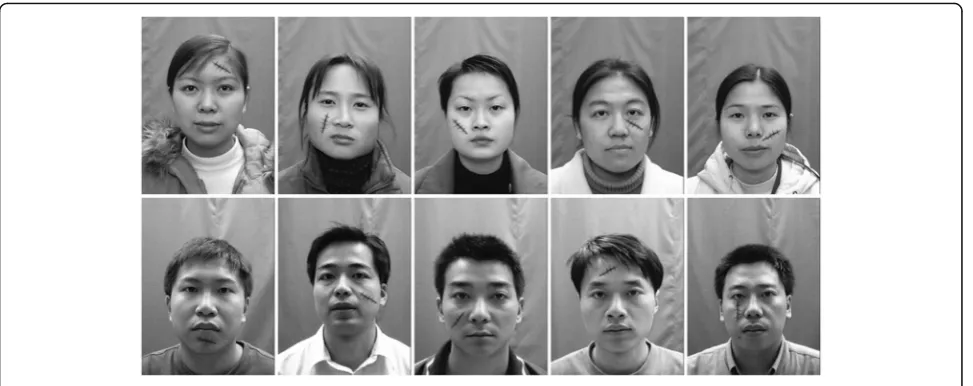 Fig. 5 Face pictures with randomly added scars