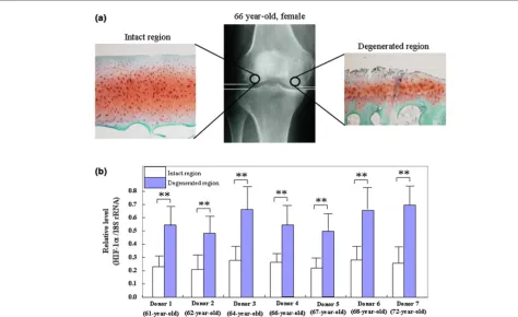 Figure 1Levels of HIF-1Levels of HIF-1αα mRNA in the articular cartilage from patients with osteoarthritis (OA)