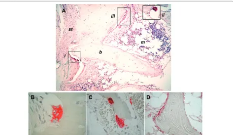 Figure 2. Bone cells in the synovial and subchondral compartment in rheumatoid arthritis