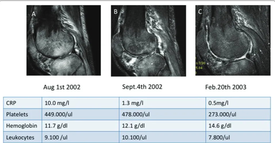 Table 4. Common autoimmune manifestations in common variable immunodefi ciency