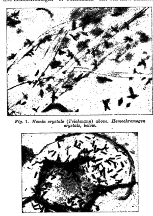 Fig. 1. Hemin crystals (Teichmann) above. Hemochromogencrystals, below.