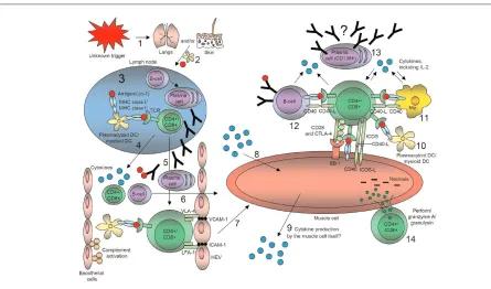Figure 3Hypothetical involvement of T lymphocytes, B lymphocytes, and dendritic cells (DCs) in idiopathic inflammatory myopathies