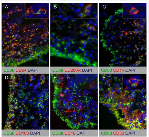 Figure 4 Double immunofluorescence stainings of CD68 and macrophage polarization markers on synovial tissue from chronicinflammatory arthritis