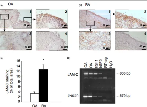 Figure 1Expression of junctional adhesion molecule-C (JAM-C) in human arthritic synoviumExpression of junctional adhesion molecule-C (JAM-C) in human arthritic synovium