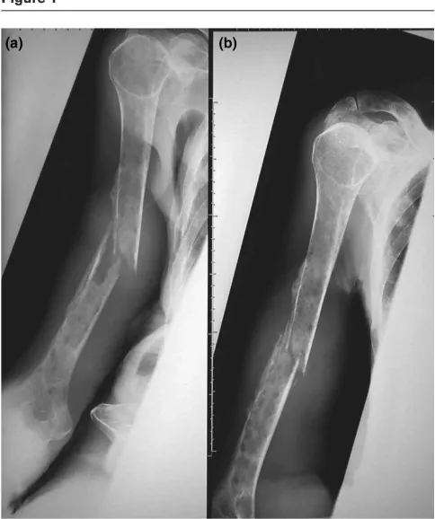Figure 1often not altered and may in fact be suppressed for reasonsthat are not entirely clear but may involve Dickkopf (DKK)1