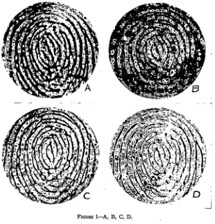 FIGURE -A, tests The have numerous been submitted photomicrographs B, C, D.made in connection with theseto various fingerprint experts in this