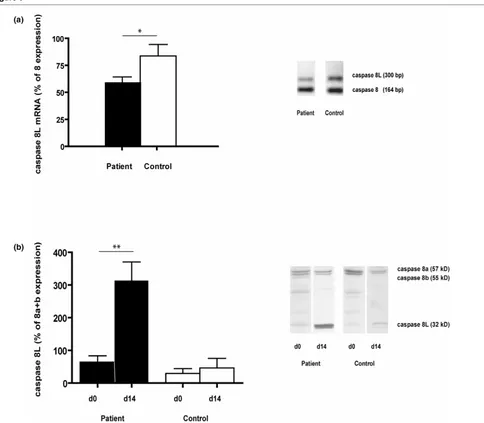 Figure 5Caspase 8(L) expression. The expression of caspase 8(L) was analyzed at the transcriptional and protein expression levels (Caspase 8(L) expressionn = 15 for both groups n (a) 