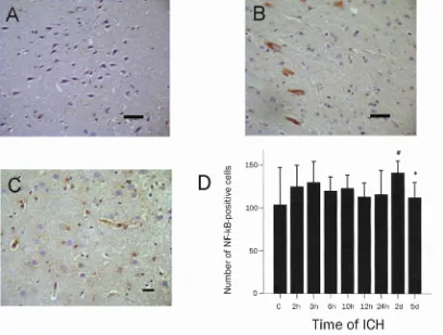 Figure 5 Using the dry-wet weight method, we found that cerebral edema was significant at the acute stage and resolved slightly from 6 to 12 hours after ICH