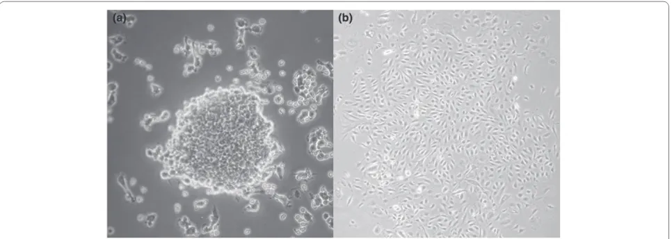 Figure 1. Colony-forming units. (a) Endothelial cell colony-forming unit. Non-adherent mononuclear cells grown on fi bronectin form colonies after 4 to 9 days