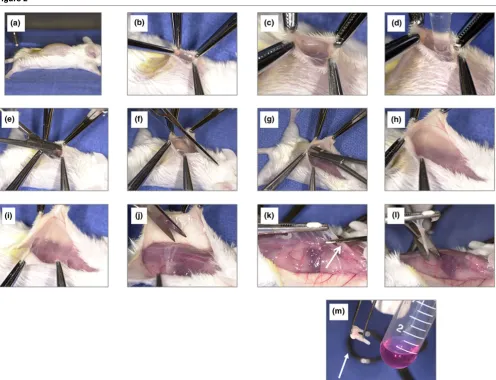 Figure 2Key steps in the separation of the membrane from the overlying soft tissuesKey steps in the separation of the membrane from the overlying soft tissues