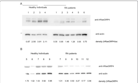 Table 3 Clinical profiles and sequenced hRasGRP4 cDNAs of the patients and healthy controls whose peripheral bloodsamples were obtained simultaneously as those in Figure 4A